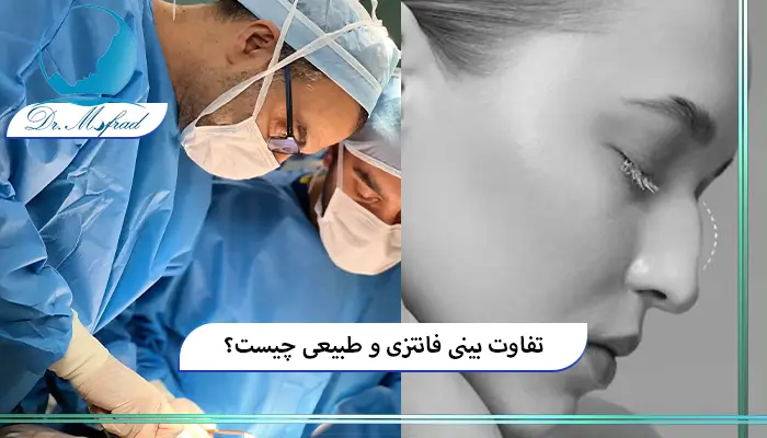 مزایای عمل بینی طبیعی و فانتزی