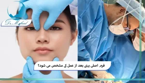 روند تغییرات بینی پس از جراحی