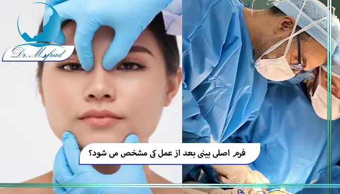 روند تغییرات بینی پس از جراحی