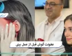 عفونت گوش قبل از عمل بینی
