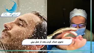 چند روز بعد از جراحی بینی مجاز به استحمام هستم؟