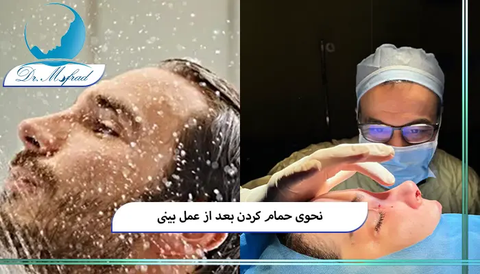 چند روز بعد از جراحی بینی مجاز به استحمام هستم؟