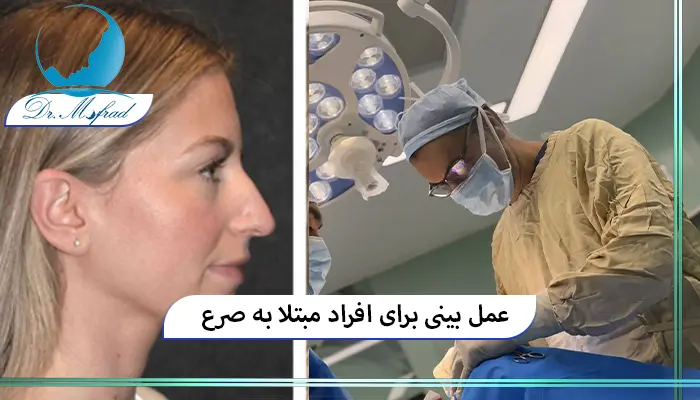 آیا بیماری صرع مانع جراحی بینی می‌شود؟
