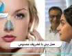 عمل بینی با غضروف مصنوعی
