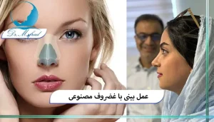 عوارض استفاده از غضروف مصنوعی