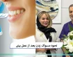 نحوه مسواک زدن بعد از عمل بینی