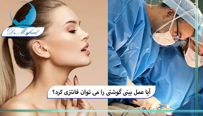 آیا بینی گوشتی هم می‌تواند فانتزی کرد؟