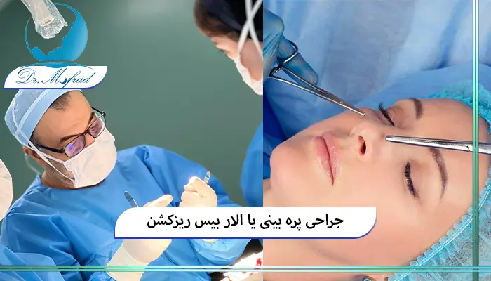 آلارپلاستی چیست؟