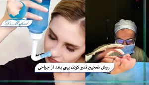 مدت زمان شستشوی بینی بعد از عمل