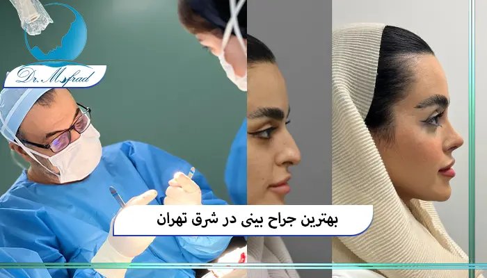 اهمیت انتخاب بهترین جراح بینی