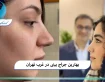 بهترین جراح بینی در غرب تهران