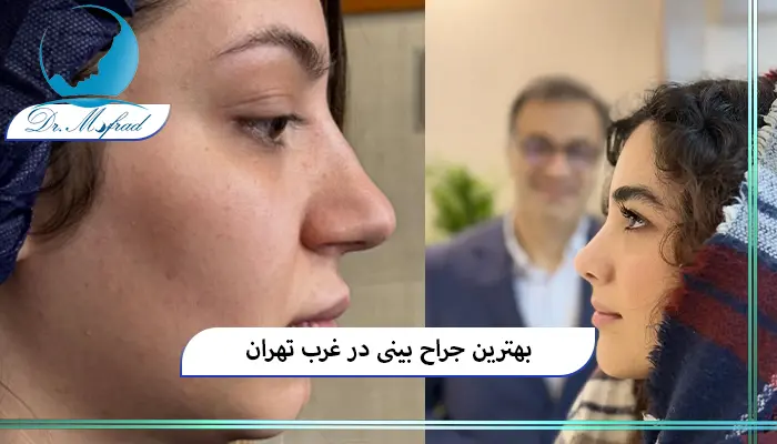 عمل بینی استخوانی در تهران