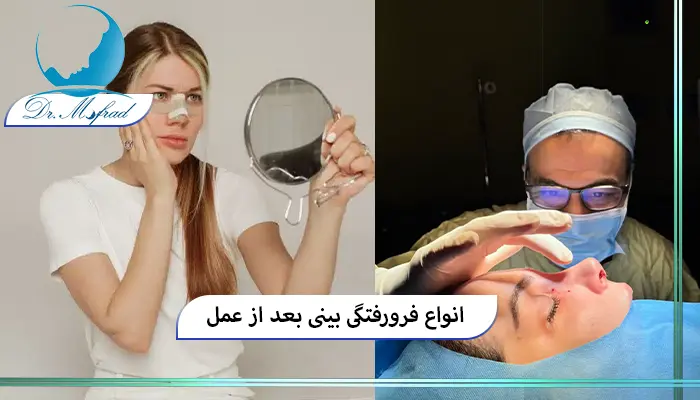 علت فرورفتگی بینی بعد از عمل چیست؟