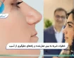 خطرات ضربه به بینی عمل‌شده و راه‌های جلوگیری از آسیب