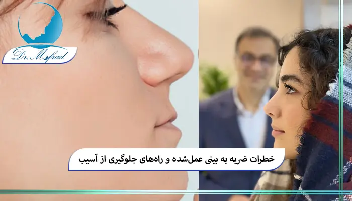 عوارض بلند مدت ضربه به بینی عمل شده