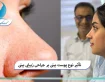 تأثیر نوع پوست بینی بر جراحی زیبایی بینی
