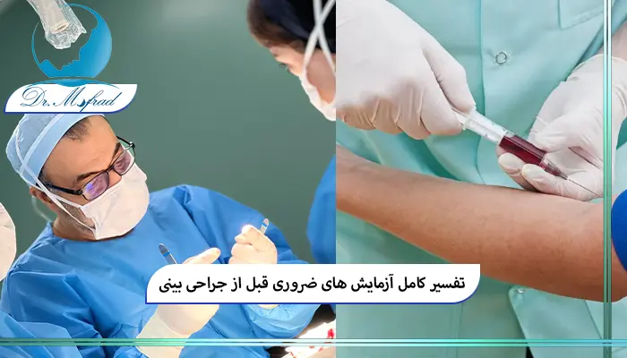 آزمایش ‌های ضروری قبل از عمل بینی کدام‌اند؟