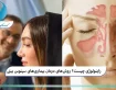 راینولوژی چیست؟ روشهای درمان بیماریهای سینوس بینی