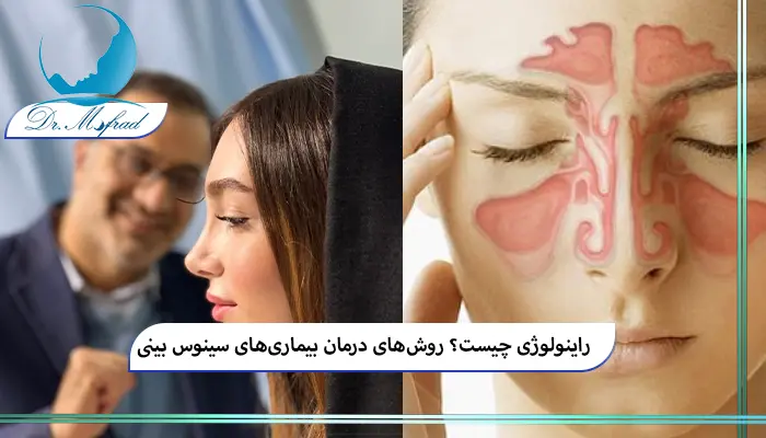 بهترین روش ‌های درمان سینوزیت حاد و مزمن