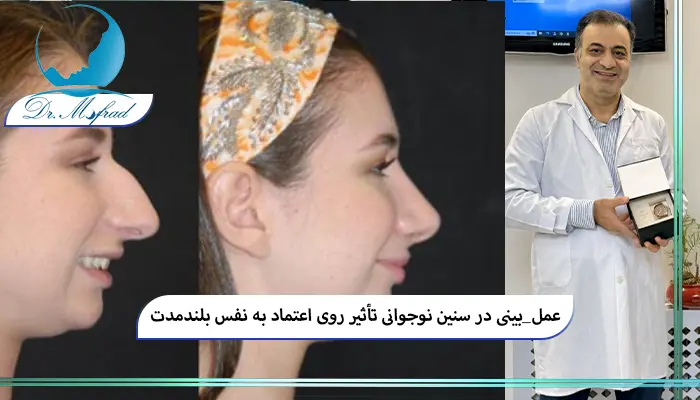 عمل بینی در نوجوانی