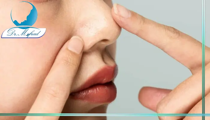 اهمیت پوست در جراحی بینی