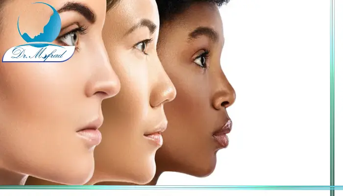 عمل بینی شرقی