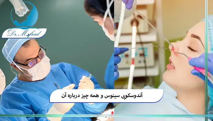 ‌آندوسکوپی سینوس چیست؟