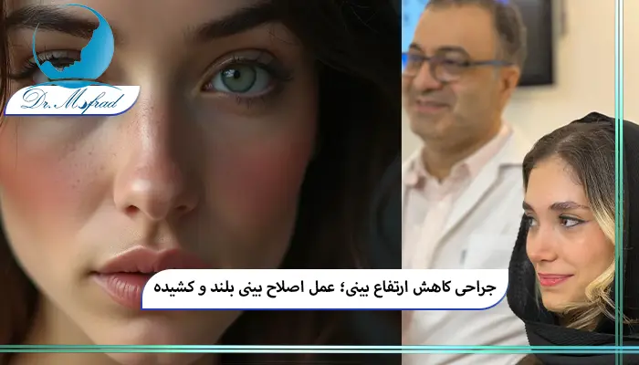 بینی بلند و کشیده