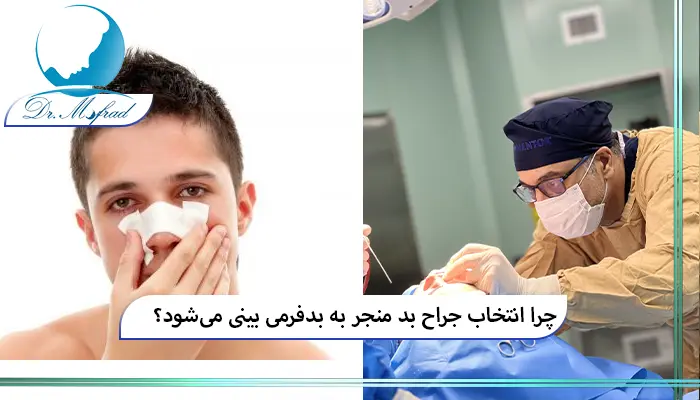 نقش مهارت جراح در موفقیت عمل جراحی بینی