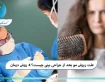 علت ریزش مو بعد از جراحی بینی چیست؟ ۴ روش درمان
