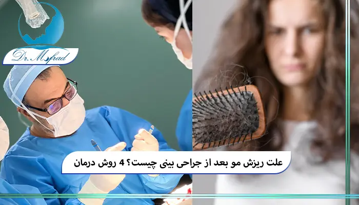 ریزش مو بعد از عمل بینی چقدر طول می‌کشد؟