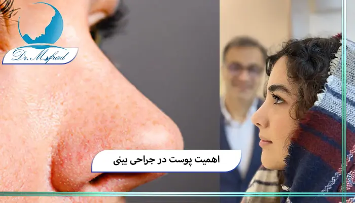 اهمیت پوست در جراحی بینی