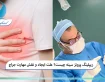 ریپلینگ پروتز سینه چیست؟ علت ایجاد و نقش مهارت جراح