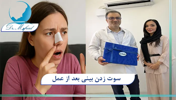 سوت زدن بینی بعد از عمل