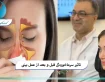 تاثیر سرماخوردگی قبل و بعد از عمل بینی