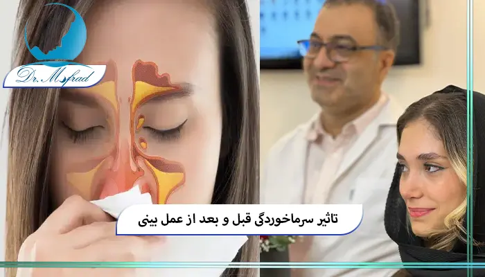 تاثیر سرماخوردگی قبل از عمل بینی