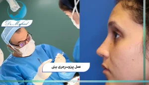 ترکیب پیزوسرجری با جراحی باز بینی