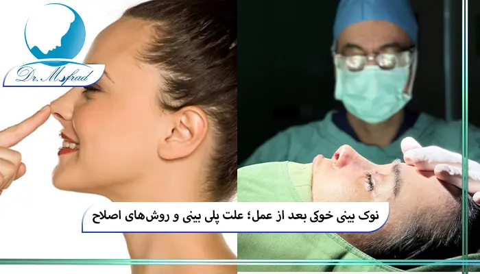 آیا پلی بینی یا نوک بینی خوکی قابل اصلاح است؟