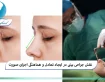 نقش جراحی بینی در ایجاد تعادل و هماهنگی اجزای صورت