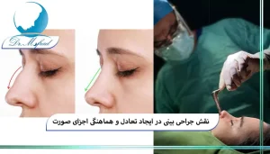 نقش بینی در هارمونی و تعادل صورت