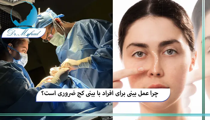 علل انحراف یا کجی بینی