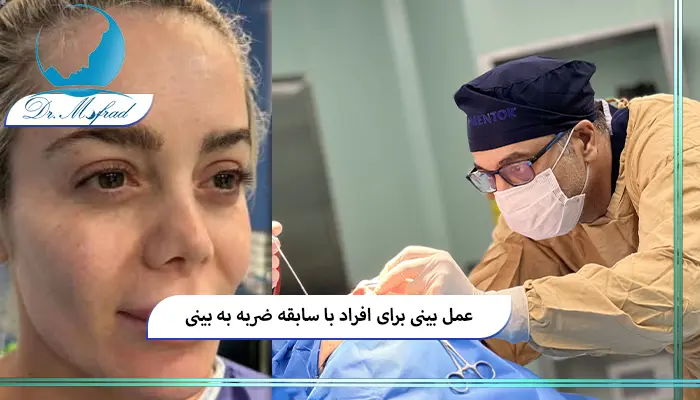 روش‌های جراحی برای اصلاح بینی آسیب دیده