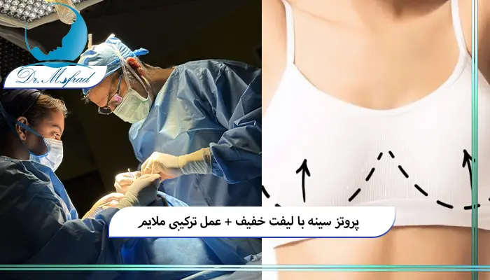 پروتز سینه همراه با لیفت خفیف چیست؟