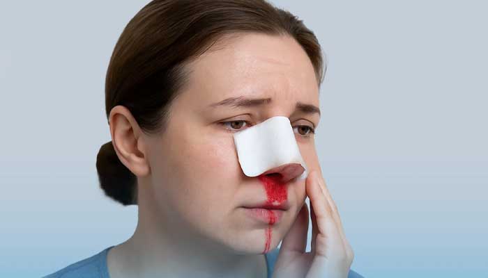 تاثیر آسپرین و ایبوپروفن بر خونریزی حین و بعد عمل بینی