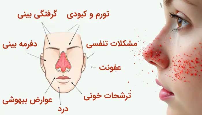 چرا انتخاب جراح بد منجر به بدفرمی بینی می‌شود؟