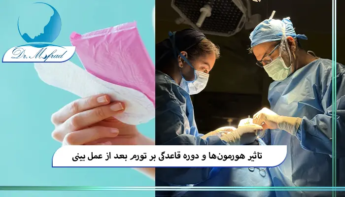 تاثیر چرخه قاعدگی بر میزان تورم بعد از عمل بینی
