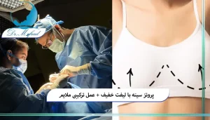 پروتز سینه همراه با لیفت خفیف چیست؟