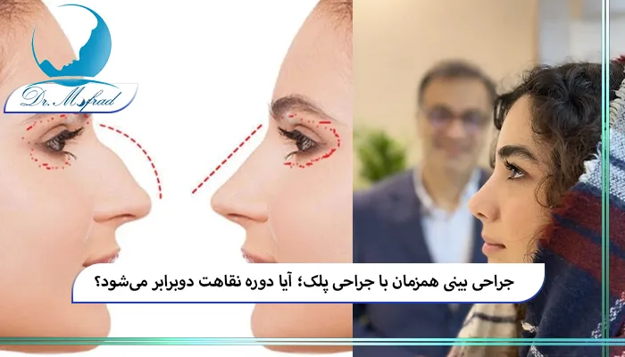 مزایای ترکیب جراحی بینی و پلک در یک جلسه
