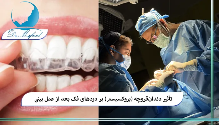 بروکسیسم چیست و چرا بعد از عمل بینی اهمیت دارد؟