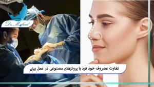 مزایای استفاده از غضروف طبیعی بدن خود بیمار